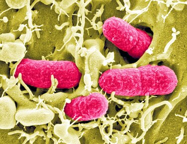 eL PELIGRO DE LA resistencia ANTIMICROBIANA