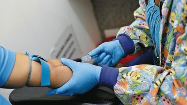 Segundo caso mundial de remisión del VIH en un paciente