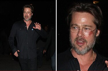 Brad Pitt aparece con moretones en la cara durante gala benéfica