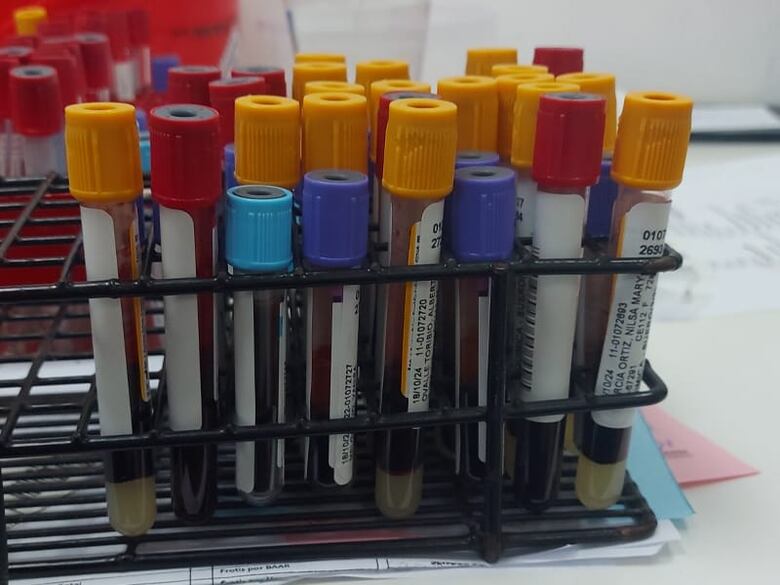 Adquieren nuevos equipos para pruebas de inmunología y serología en el Complejo Hospitalario