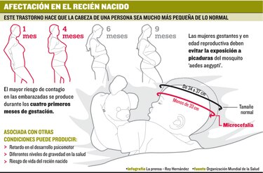 Muerte por microcefalia obliga a extremar medidas