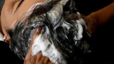 Caspa y dermatitis seborreica: más allá de la estética