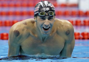 Las marcas circulares de Phelps por 'cupping' disparan el orgullo en China