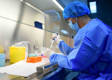 ¿Qué saben hasta ahora los científicos del langya henipavirus identificado en China?