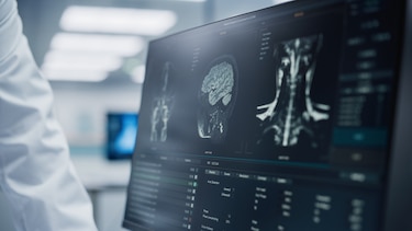 Inconformidad con proceso de millonaria licitación de radiología e imagenología de la CSS