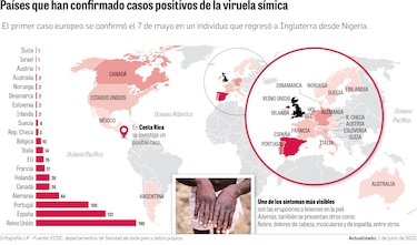 Brote de viruela símica: ¿qué razones hay para ser optimista?