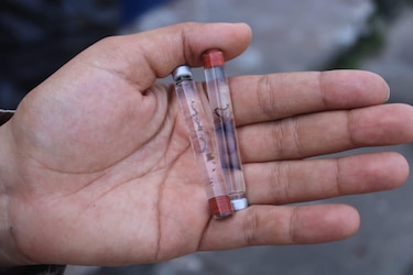 Aumenta el dengue en Panamá: se registran 10 casos graves y 6 muertes