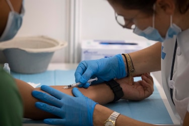 Estados Unidos impulsa la vacunación sin cita para frenar la viruela del mono