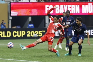 Musiala  ‘será operado en breve’ de la grave lesión que sufrió ante el PSG