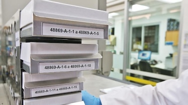 Banco de Suero, una colección de 50 años de estudio