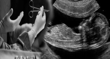 Juez de Estados Unidos bloquea temporalmente ley que prohíbe mayoría de abortos en Texas