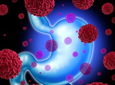 La ciencia busca vencer el cáncer gástrico