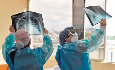 Más de 11 mil atenciones por secuelas de la Covid-19 en 11 meses