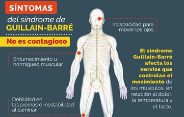 Perú emite una alerta epidemiológica ante más de 100 casos del Síndrome de Guillain Barré