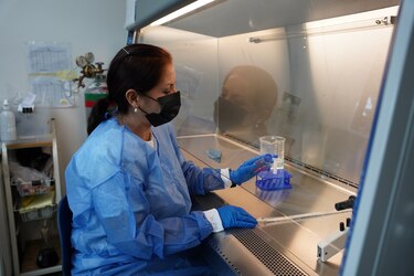 Estudio sobre  toxoplasmosis revela alta seroprevalencia  en mujeres embarazadas