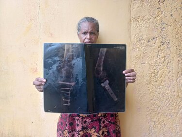 Entre el abandono y el dolor: sobrevivientes de atropellos por metrobús exigen justicia