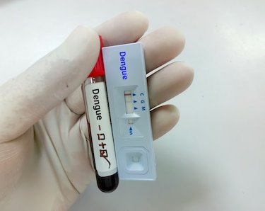 ¿Qué serotipos de dengue predominan en Panamá?