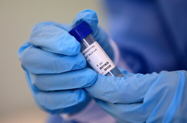 Autoridades detectan venta no autorizada de pruebas caseras para determinar Covid-19