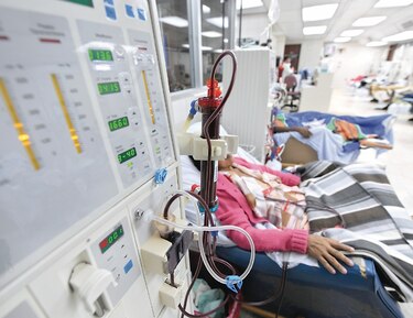Virus acecha a pacientes de salas de hemodiálisis 