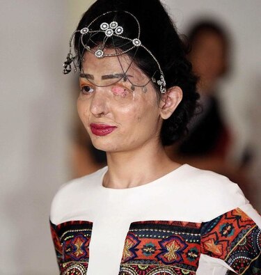 Modelo desfigurada por ácido abrió la Fashion Week de Nueva York
