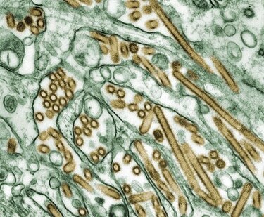 La OMS ve ‘bajo’ el riesgo de transmisión sostenida de la gripe aviar A(H5N1) entre humanos