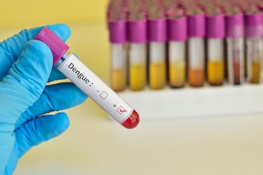 Científicos brasileños advierten de un posible brote de dengue en las Américas