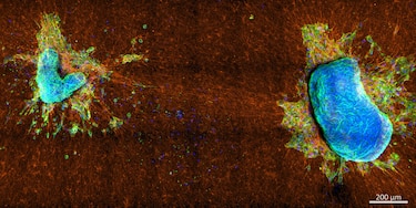 Un estudio arroja luz sobre la capacidad de las células cancerosas para migrar