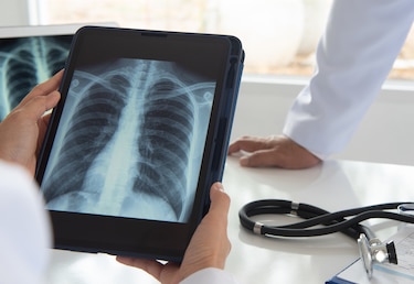 Las regiones de Bocas del Toro, Guna Yala y Panamá enfrentan altas tasas de tuberculosis