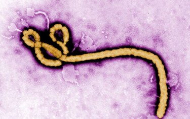 Sierra Leona registra nuevo caso de ébola