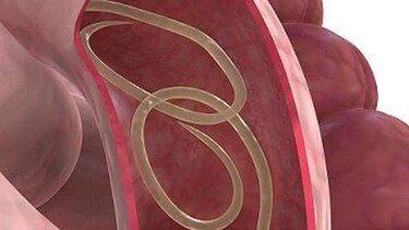Malestar gastrointestinal: ¿serán parásitos?