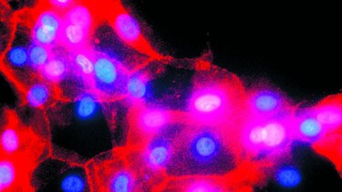 Errores en ADN, clave en el cáncer