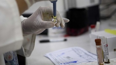 Texas confirma caso de zika por transmisión sexual