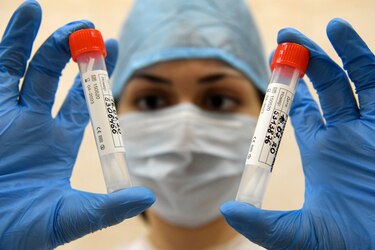 Rusia quiere ganar la carrera por la vacuna contra el coronavirus