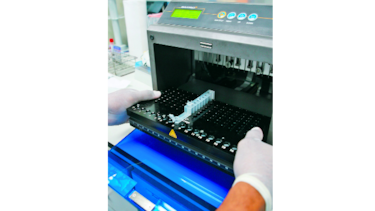 Las prioridades de la investigación en salud