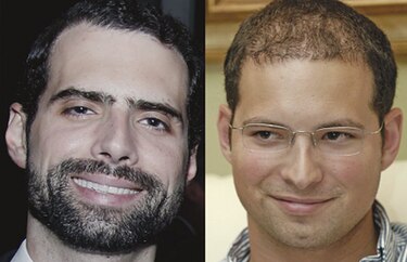 Hermanos Martinelli Linares, ligados a Blue Apple