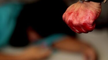 Proponen cárcel de 12 a 15 años a quien lesione de gravedad la cara a un familiar