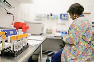 Pandemia pone en riesgo los logros contra el VIH