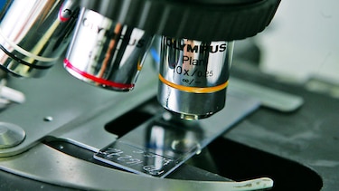 Las prioridades de la investigación en salud