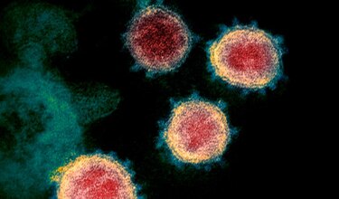 Suben a 21 los monitoreados en Herrera por el protocolo relacionado al nuevo coronavirus