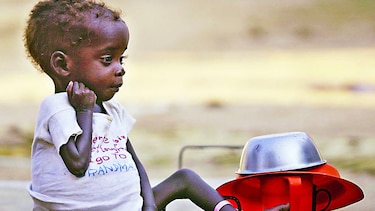 Niños desnutridos necesitan tratamiento