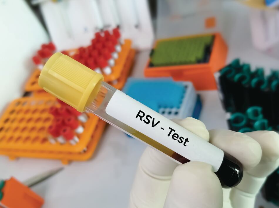 Panamá aporta datos para el registro global de mortalidad por el virus respiratorio sincitial