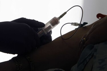 Un examen de sangre experimental detecta el cáncer de forma precoz