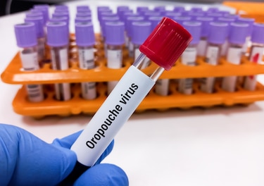 OMS considera ‘alto’ el riesgo sanitario por brotes de oropouche en países de América