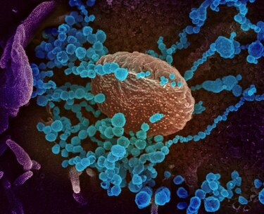 Moderna no aplicará las patentes de su vacuna contra la Covid-19 en la pandemia
