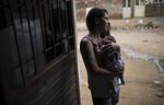 Brasil busca un nexo entre malformaciones y virus del zika