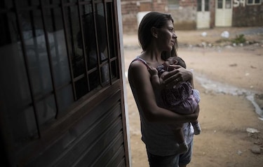 Brasil busca un nexo entre malformaciones y virus del zika