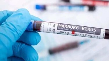 La OMS celebra el fin del brote del virus de Marburgo en Guinea Ecuatorial