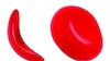 10 mitos de la anemia falciforme