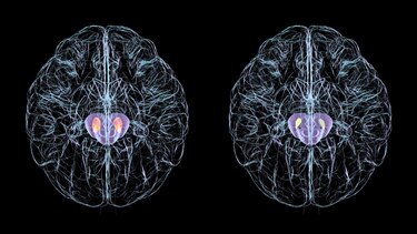 ¿Puede la estimulación tecnológica mejorar el funcionamiento de nuestro cerebro?