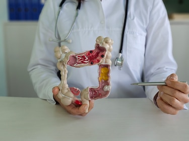 Factores genéticos y de estilo de vida detrás del cáncer de colon en Azuero